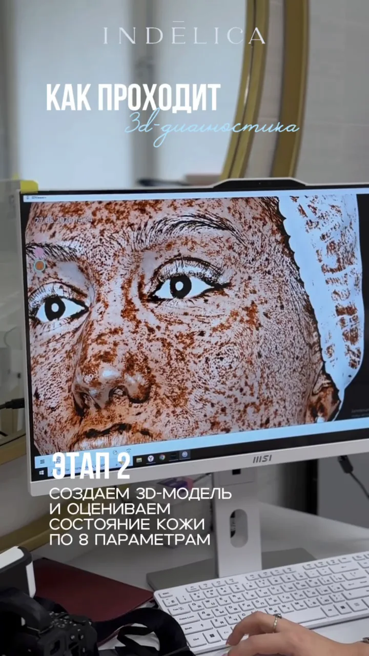3D-диагностика