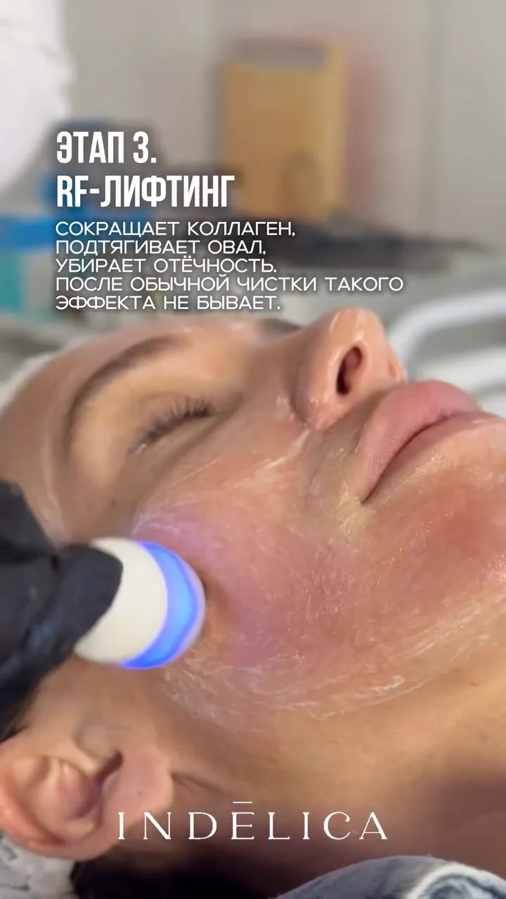 чистка ProFacial · как проходит