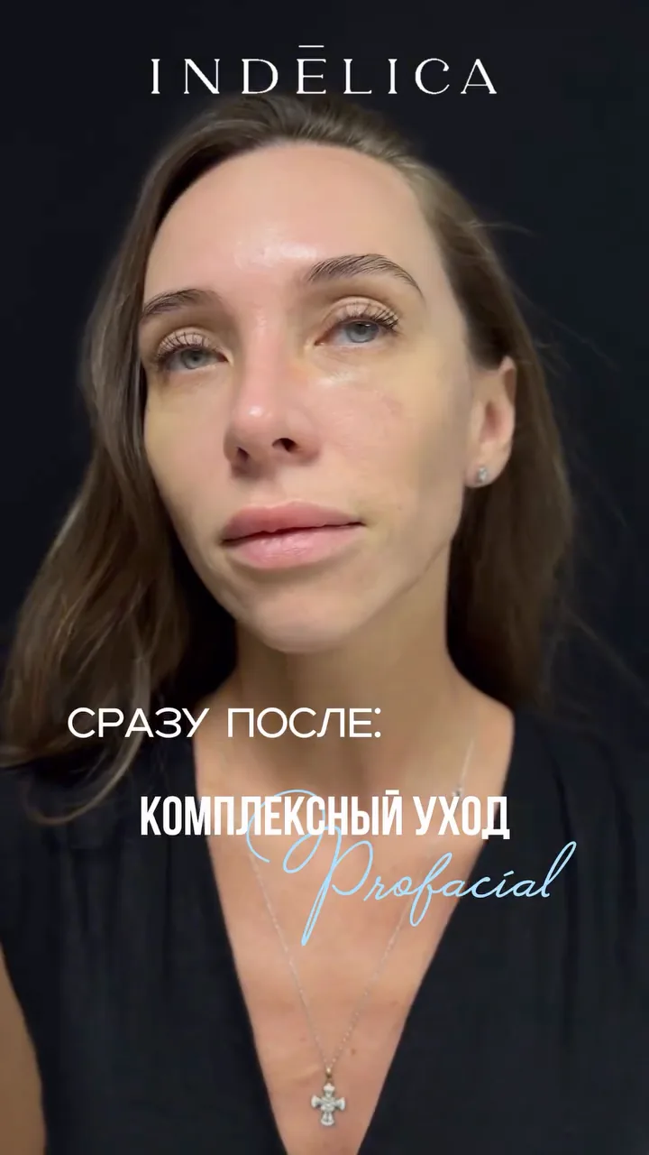 чистка ProFacial · до / после
